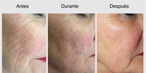 xela rederm clinica dra zaror