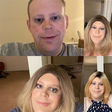 143 best r/trans Top images on Pholder | Just woke up from top surgery 😊😊😔