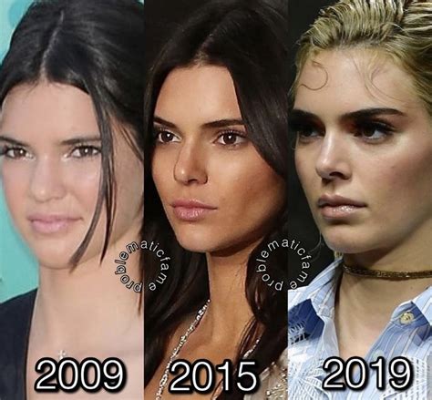 Kendall jenner surgery | Belleza, Corbatin