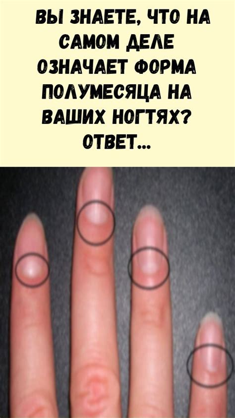 Вы знаете, что на самом деле означает форма полумесяца на ваших ногтях ...