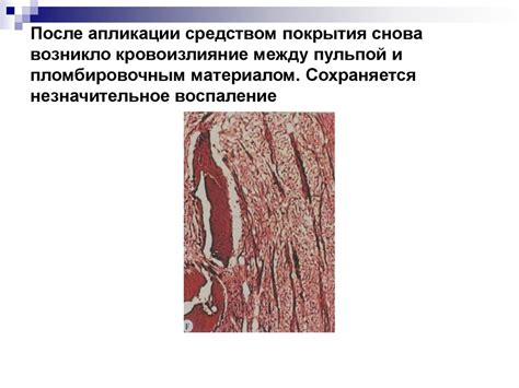Болезни зубов (пульпит и кариес) - презентация онлайн