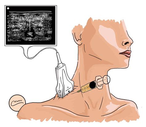 Neck Lumps - Differential Diagnosis - Investigation - TeachMeSurgery