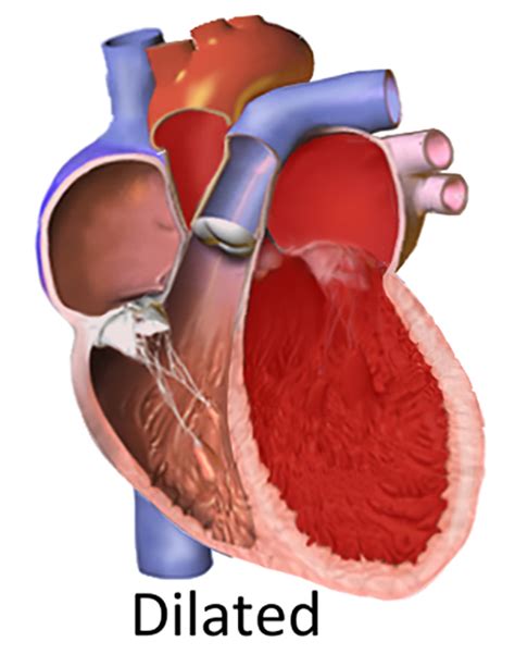 Bagging the Culprit: Japanese Researchers Identify BAG5 Mutations as ...