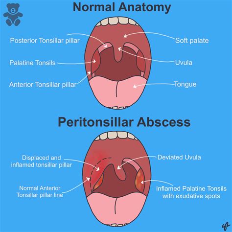 TeachMePaediatrics - Making Physiology Simple