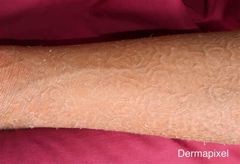 Dermapixel: noviembre 2023