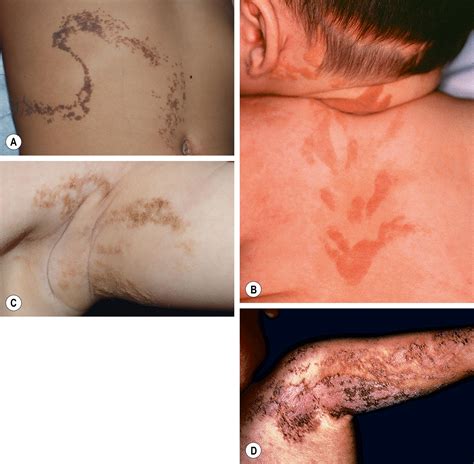 Mosaic Skin Conditions - Clinical Tree