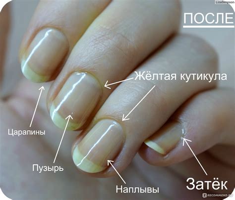 Виды кутикулы (48 фото) - картинки modnica.club