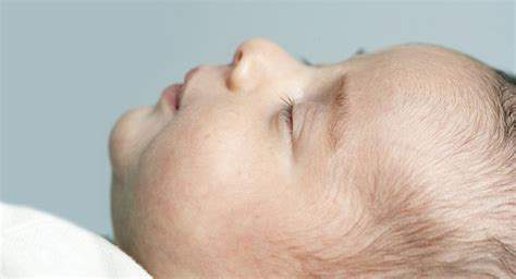 Cabeça Do Bebe Amassada - Dormir de barriga para cima deixa a cabeça do bebê amassada? | BabyCenter