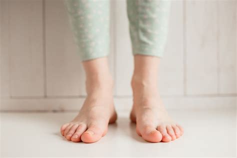 Hallux Valgus 1 степени стопы: симптомы вальгусной деформации ...