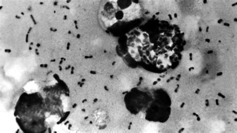 中国・内モンゴルで腺ペスト感染者 当局が予防策を強化 - BBCニュース