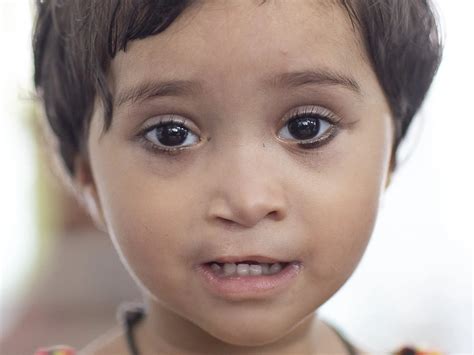 India | Operation Smile