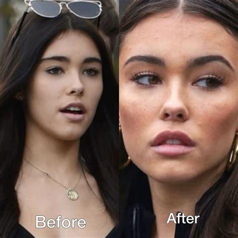 Best 11 Lauren Sanchez Plastic Surgery: A Closer Look At The Plastic ...