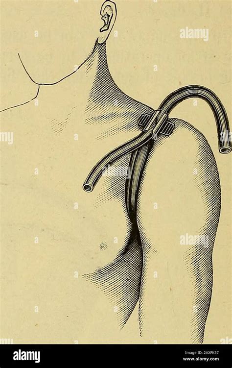 The surgeon's handbook on the treatment of wounded in war : a prize ...