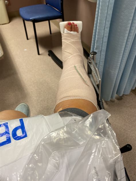 Building an Arch: Flat Foot Surgery - The Big Day