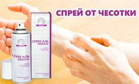 Самая эффективная мазь от чесотки: быстрое лечение инфекции у человека