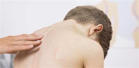Skoliose: Ursachen, Symptome und Behandlung - HEROLD.at