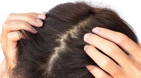 grow hair faster eraorganicscom