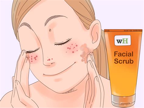 how to get rid of redness on face 3