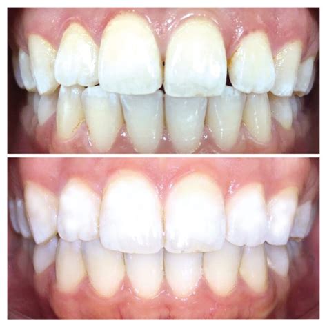 What TrioClear™ can do for you - TrioClear™