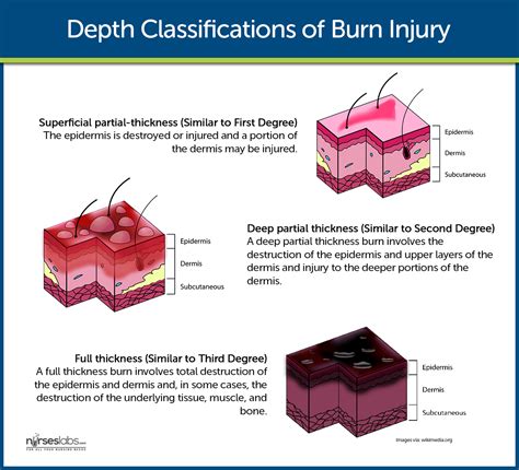 burn injury nursing care management  study guide