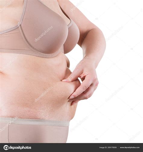 Tummy tuck, flabby skin on a fat belly, plastic surgery concept — Stock