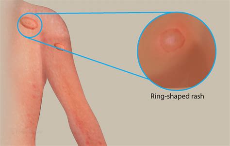 Health Condition : Symptoms, Causes, Treatment and More