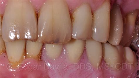 Tampa Bay Dental Studio - Tampa Advanced Dental Solutions | Tampa FL