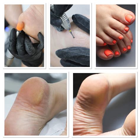 Revitalize Your Feet with Medical Pedicures - The Fit Care