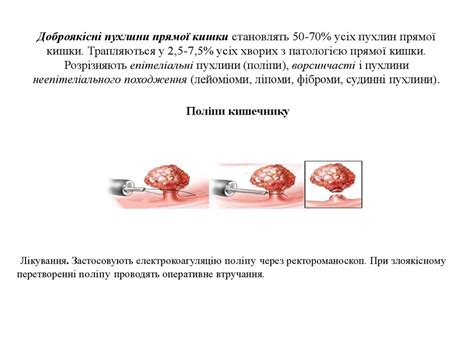 Догляд за хворими з хірургічними захворюваннями прямої кишки - online ...