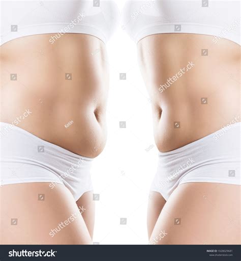 Womans Body Before After Weight Loss Stock Photo 1028029681 | Shutterstock