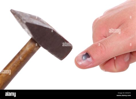 Hammer and human finger with black bruised nail, subungual hematoma ...