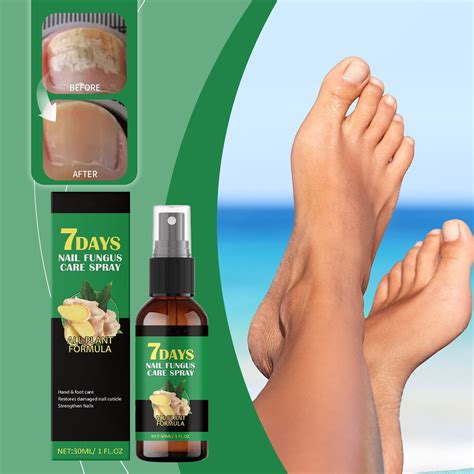 7 Days Nail Fungus Treatment Solution Hand Foot Nail Care Liquid