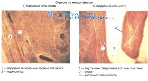 Регенерация кости после перелома. Как зарастает кость после перелома?