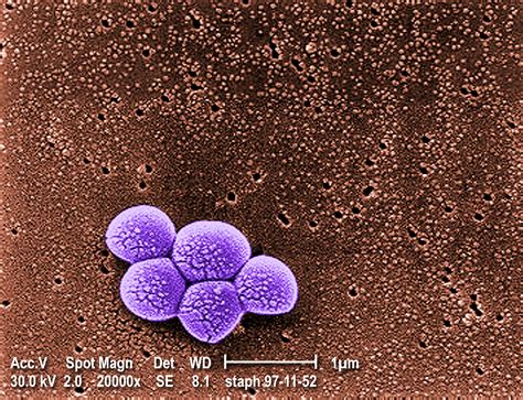 Foto gratis: raggruppamento, meticillina, resistente, Staphylococcus ...