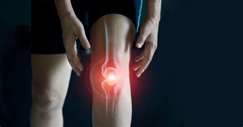 What Is Patellofemoral Pain Syndrome? | PainScale