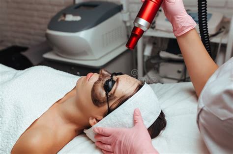 The Procedure is Carbon Peeling Stock Image - Image of laser, closeup ...