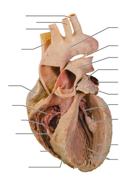 Interior anatomy of the human heart cadaver Diagram | Quizlet