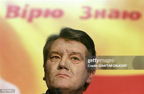 282 Poisoning Of Viktor Yushchenko Stock Photos, High-Res Pictures, and ...