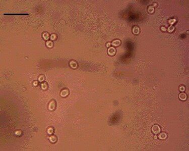 Microscopic observation of yeast zygote. | Download Scientific Diagram