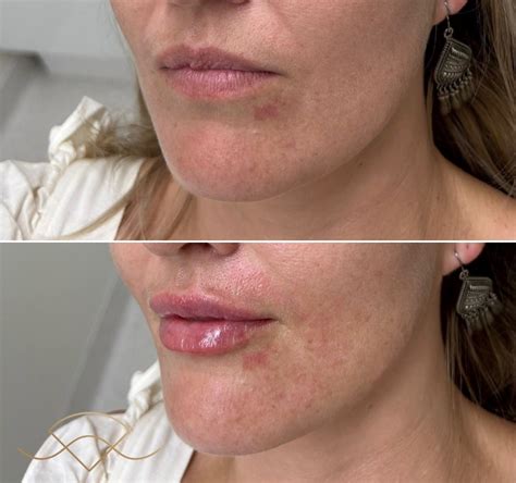 gallery shellharbour skin