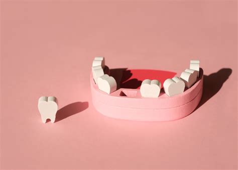 knocked  teeth    bookcliff family dental