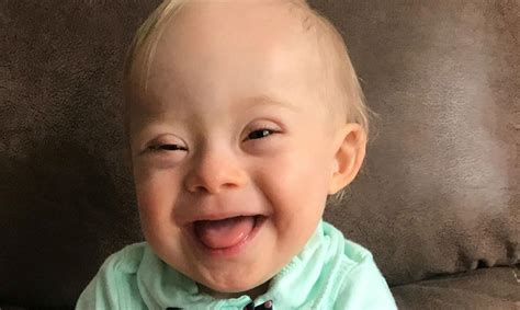 Bebê Com Síndrome De Down - Un bebé con síndrome de Down será la nueva imagen de Gerber - El Nuevo Día