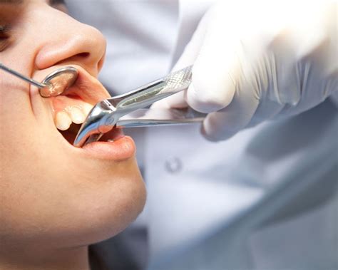 how to pull out tooth at home 9