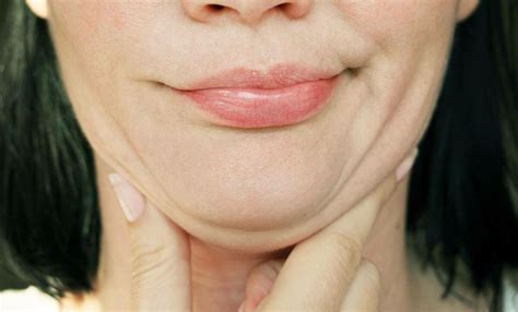 Как убрать второй подбородок | Face Clinic | Клиника косметологии в ...