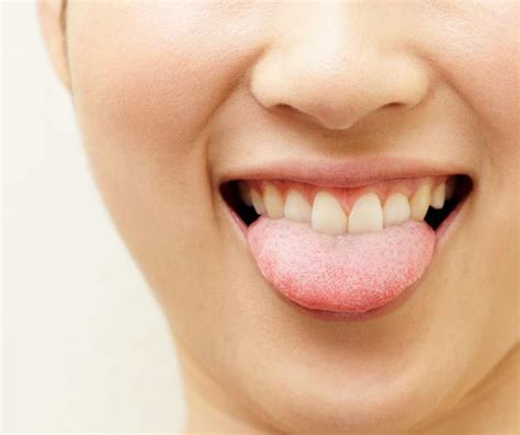 lisp  speech impediment