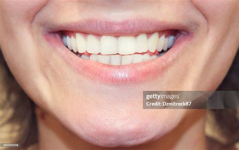 Smiling Girl Closeup White Teeth Close Up High-Res Stock Photo - Getty ...