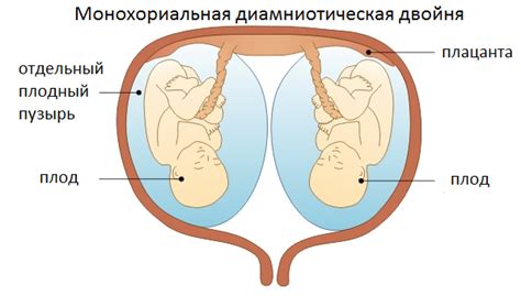 Многоплодная беременность, беременность двойня, двойняшки, близнецы