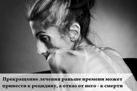 Анорексия: причины и последствия - Красота и здоровье - Calorizator.ru