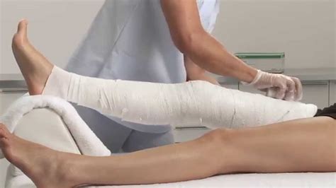 Plaster of Paris Knee Circular Cast Application - YouTube
