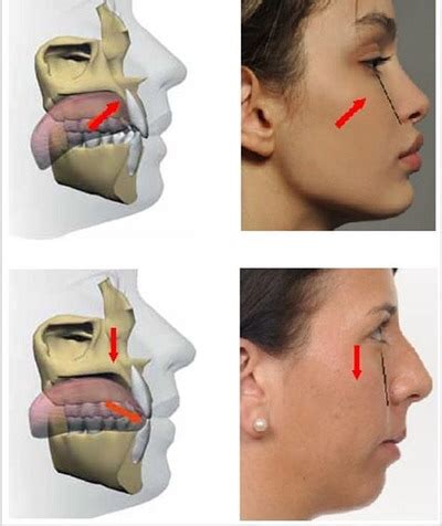 Мьюинг: всего одна привычка вернет лицу молодость и симметрию Facial ...